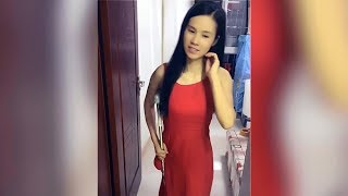 Lovely Amputee Girl in Dress #1
