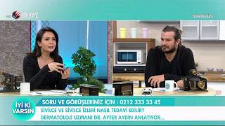 Sivilce ve sivilce izleri tedavisi