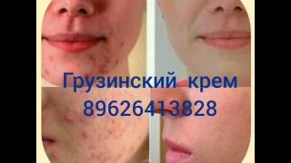 грузинский крем до и после отзывы