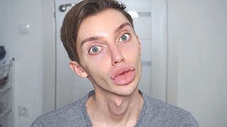 НЕ КАЧАЙТЕ ГУБЫ!!! НИКОГДА!!!
