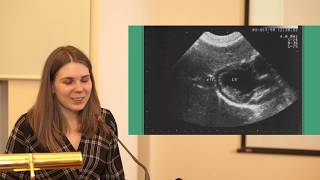Амиодарон индуцированные заболевания щитовидной железы часть 1