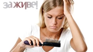 Как бороться с облысением? - За живе! / За живое! - Выпуск 2 - 21.04.15
