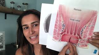 Tight muscles and Anal fissures