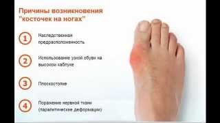 Косточка на большом пальце ноги. Valgus Pro Plus Medicus