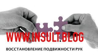 Восстановление подвижности рук после инсульта.