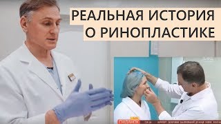 ⭐️Ринопластика ? Реальная история ? отзыв о пластика носа пластический хирург Павел Денищук