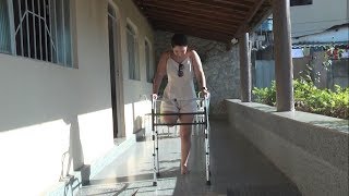 Jovem tem a perna amputada após levar tiro e busca ajuda para implantar prótese