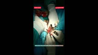 #vaginal tightening surgery in indore by dr.sumeet jaiswal|vaginal tightening surgery cost