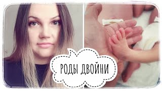 РОДЫ ДВОЙНИ! РОДЫ В АЛМАЗОВА! КЕСАРЕВО
