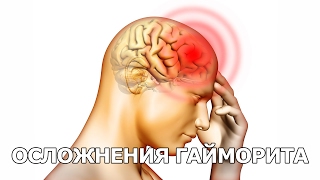Осложнения гайморита