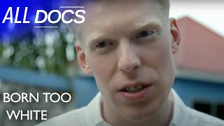 Born Too White: What It's Like To Have Albinism in Tanzania | Albino Documentary | Documental
