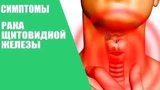 Симптомы рака щитовидной железы