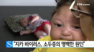 美 질병통제센터 "지카 바이러스, 소두증의 명백한 원인" / YTN 사이언스