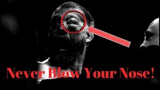 Never Blow A Damaged Nose! Here's Why.