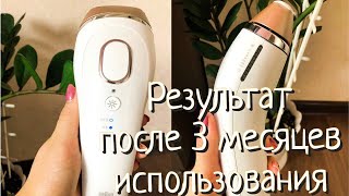 Фотоэпилятор Braun | Удаление волос | РЕЗУЛЬТАТ | Стоит ли покупать?