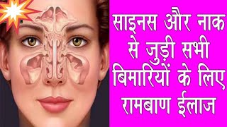 Allergy,cold, cough and sinus || Montek LC uses||  My Healthy Tips