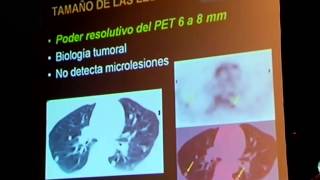 Que es el PET/CT y para qué sirve. Conferencia del Dr. Christian González