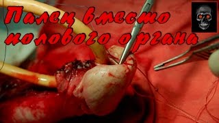 Палец вместо полового органа [Ужасающая действительность]