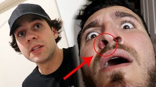 THIS DEADLY DISEASE GREW ON MY NOSE!!