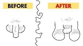 5 Things That Will Make Your Penis Shrink In Size!