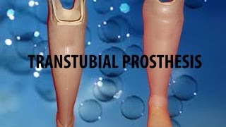 How to Walk with a Prosthetic Leg (Below the Knee Amputee)