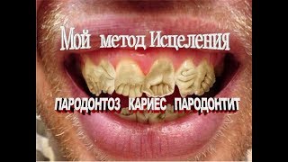 Пародонтоз, пародонтит, кариес - МОЙ РЕЦЕПТ ИСЦЕЛЕНИЯ