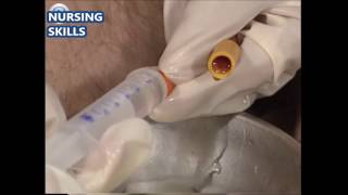 Male Catheter Insertion