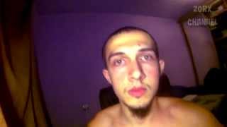 УЖАСНЫЙ прыщ на ГЛАЗУ! [ЖЕСТЬ 21+]