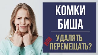 ‼️Комки Биша: УДАЛЯТЬ или ПЕРЕМЕЩАТЬ?