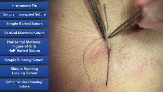 Suture Skills Course - Learn Best Suture Techniques