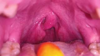 Swallowing M&M’S | Uvula tonsils and mouth video | VORE VIDEO