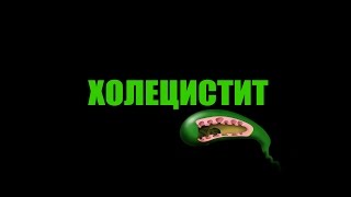 Холецистит