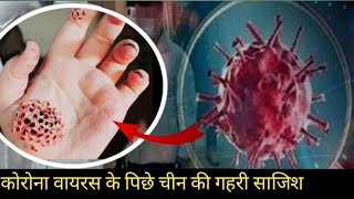 Corona Virus spread due to this mistake of China