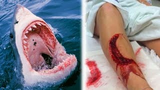 10 Unbelievable Shark Attacks