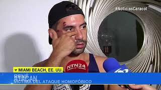 Atacan a colombiano gay en Miami