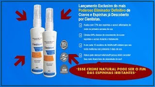 AntiAcne Funciona? Como Usar? AntiAcne Onde Comprar? Meu depoimento!