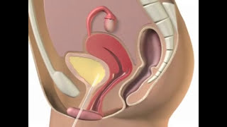 Speedicath Intermittent Catheters/women / القسطرة المتقطعة سبيدي كاث للنساء