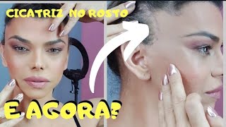 Vai ficar aparecendo a cicatriz? Olha que sensacional isso