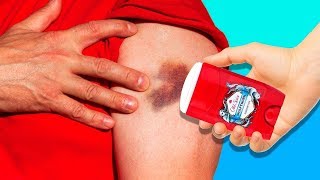 24 IMPORTANTI TRUCCHI PER LE EMERGENZA CHE DEVI SAPERE
