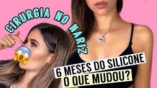 MINHA CIRURGIA DE SILICONE DEPOIS DOS 6 MESES @julianavianaoficial