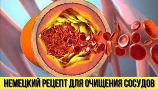 Проверенный НЕМЕЦКИЙ РЕЦЕПТ для ОЧИЩЕНИЯ СОСУДОВ Это очень ПРОСТО сделать в домашних условиях