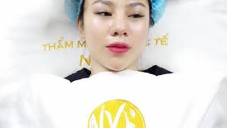 Cấy Collagen Tươi Kết Hợp Mulgwang Hàn Quốc Tại Thẩm Mỹ Viện Quốc Tế Như Ý