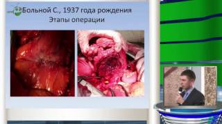 Клинический случай - рак урахуса