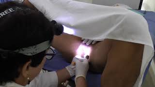 Próstata Terapia natural 100 % para evitar la cirugía.Dra Isabel García. Tel 2010882 / 0994497201