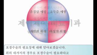 포경수술의필요성