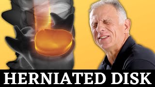 Top 3 Exercises For Herniated Disc