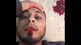 Ali Banat - Last Stage - May Allah Reward Him Ameen