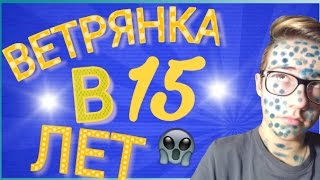 ВЕТРЯНКА В 15 лет//КАКОВО ЭТО??