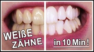 ▶︎ Weiße Zähne in 10 Minuten | Gelbe Zähne aufhellen mit diesen Hausmittel