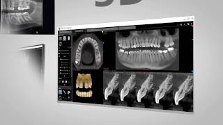 CS 8100 3D Carestream